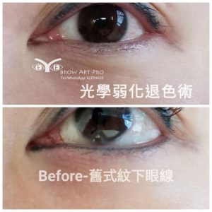洗眼線1次效果-洗老舊藍色下眼線案例