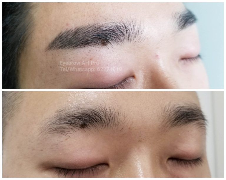 男士紋眉香港-局部眉毛缺少案例